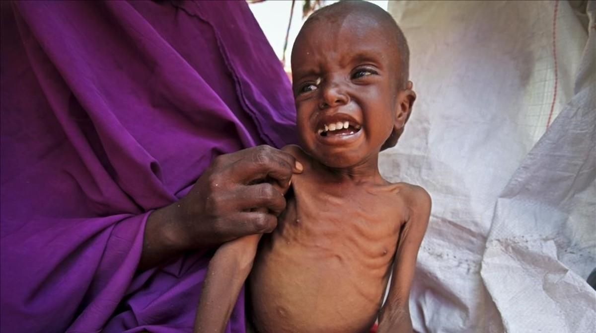 Un niño somalí de 7 años que padece malnutrición en el campo de desplazados de Garasbaley, a las afueras de Mogadiscio, la capital de Somalia. Un niño somalí de 7 años que padece malnutrición en el campo de desplazados de Garasbaley, a las afueras de Mogadiscio, la capital de Somalia.