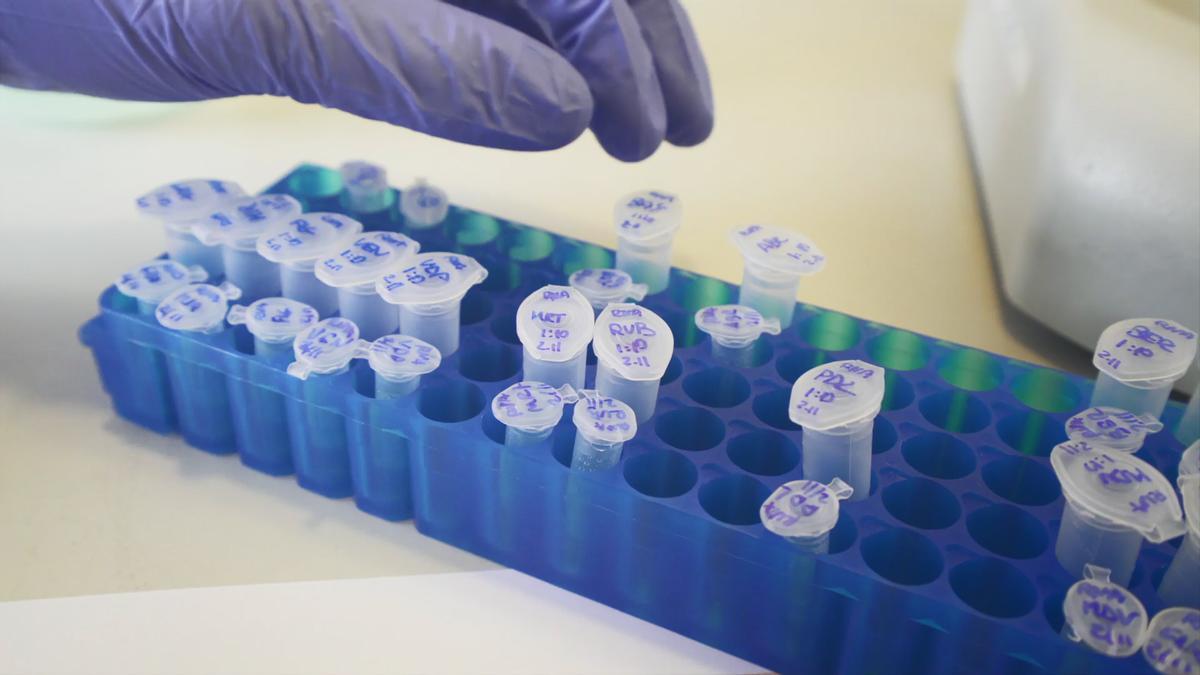 Detectada una nova variant òmicron en aigües residuals a Catalunya Detectada una nova variant òmicron en aigües residuals a Catalunya