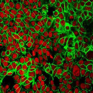 Células de cáncer de colon humano con los núcleos celulares teñidos de rojo y la proteína E-cadherina teñida de verde.