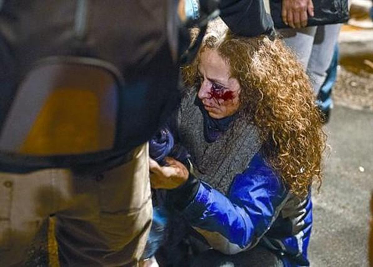 Ester Quintana, durante esta entrevista, el lunes en Barcelona. Abajo, la mujer tras recibir el impacto en el ojo, el 14-N. Ester Quintana, durante esta entrevista, el lunes en Barcelona. Abajo, la mujer tras recibir el impacto en el ojo, el 14-N.