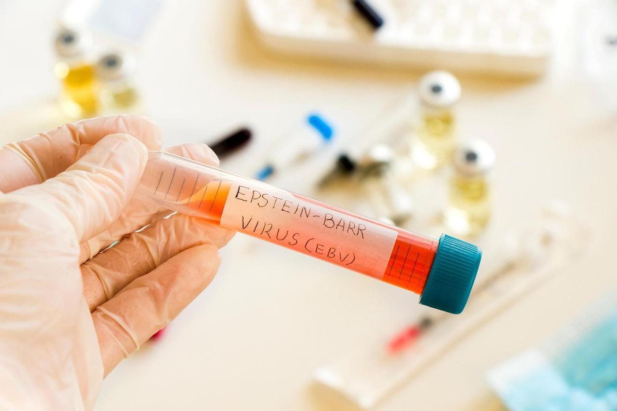 Un estudio apunta al virus de la enfermedad del beso como principal causa de la esclerosis múltiple Un estudio apunta al virus de la enfermedad del beso como principal causa de la esclerosis múltiple