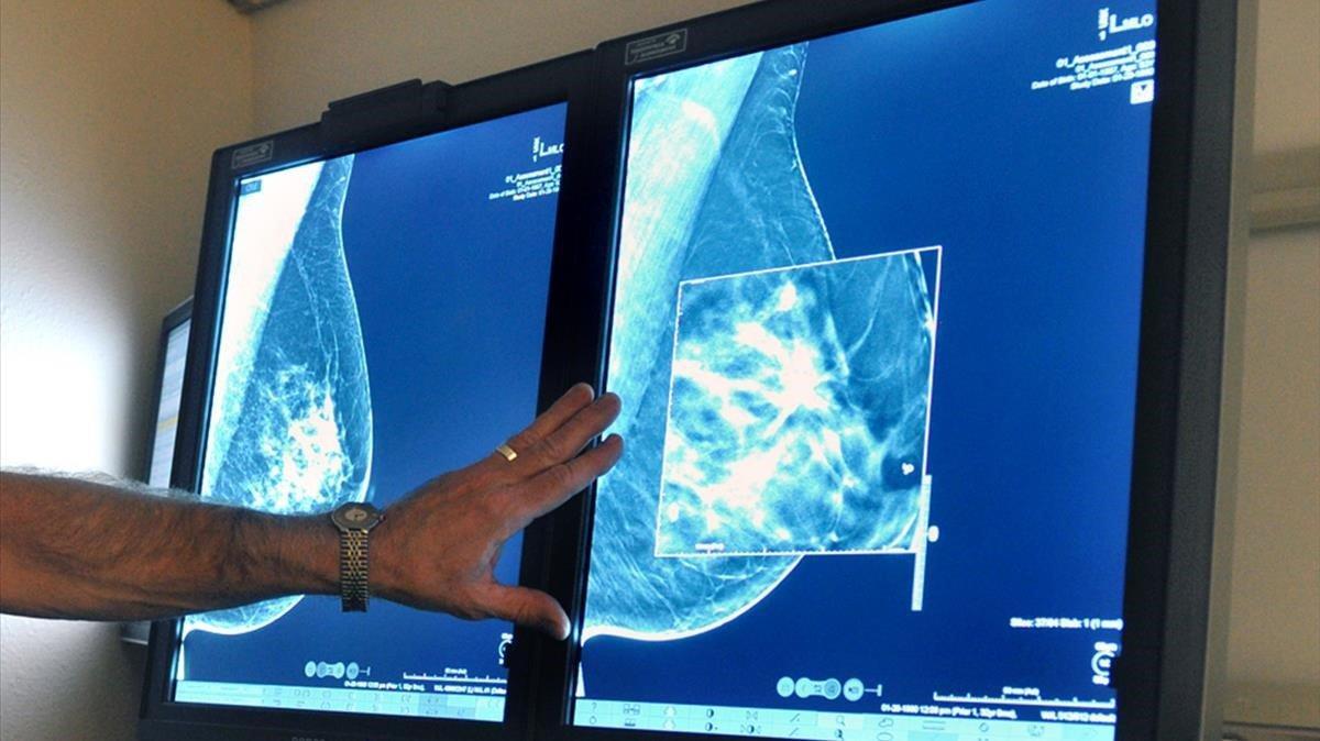 Avenç contra el càncer de mama: activar una molècula ajuda a tractar-lo