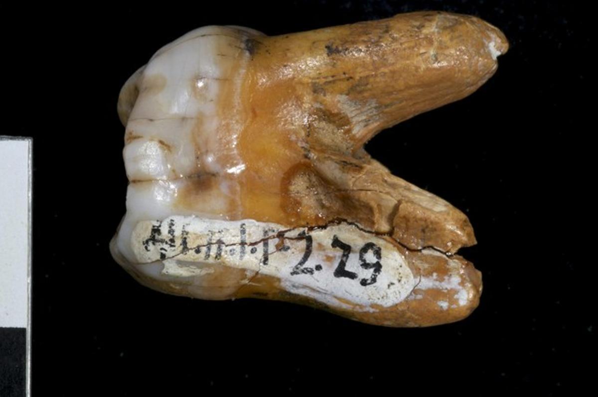 Muela de denisovano, como ha sido bautizado el homínido hallado en Siberia que murió hace al menos 30.000 años en Siberia y que pertenece a una nueva especie.