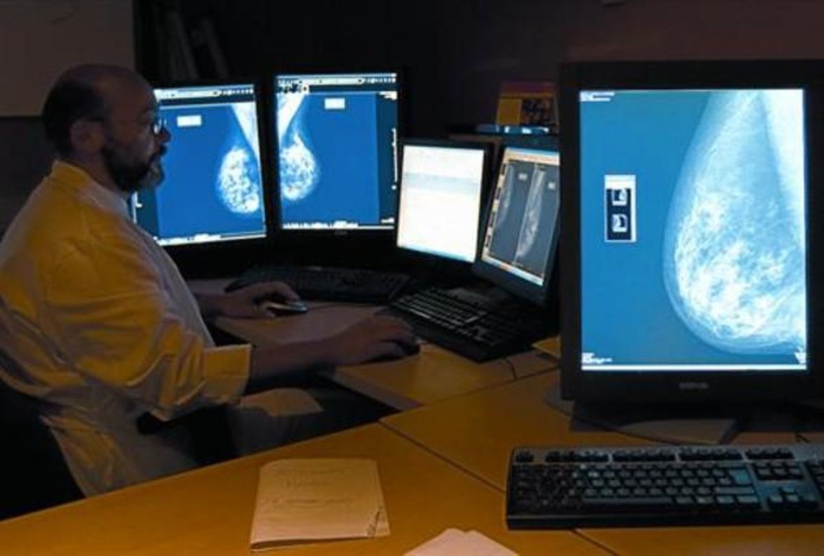 Un especialista revisa mamografías digitales en el Hospital del Mar de Barcelona. Un especialista revisa mamografías digitales en el Hospital del Mar de Barcelona.