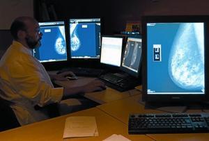 Un especialista revisa mamografies digitals a l’Hospital del Mar de Barcelona.