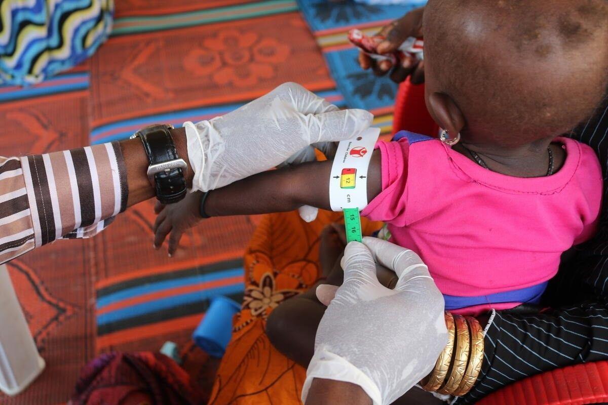 Un brote de meningitis causa la muerte de al menos 65 niños en Nigeria