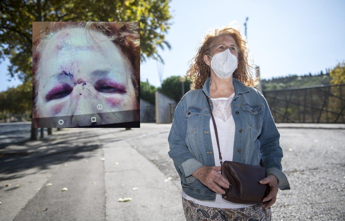 Conchi P., en el lugar donde fue atacada, junto al Sot del Migdia, en Montjuïc. En la foto pequeña, las lesiones que sufrió en la cara.