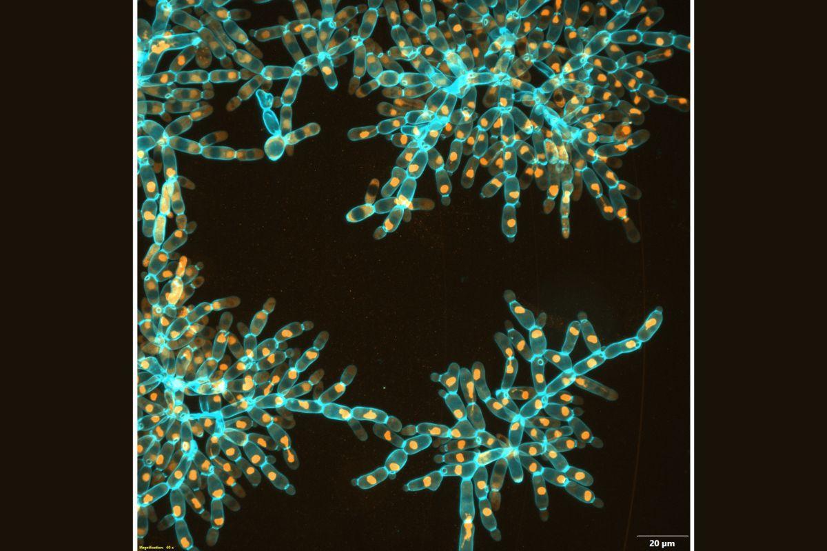 Un hongo desarrollado en laboratorio muestra cómo habría evolucionado la vida multicelular en la Tierra primitiva Un hongo desarrollado en laboratorio muestra cómo habría evolucionado la vida multicelular en la Tierra primitiva