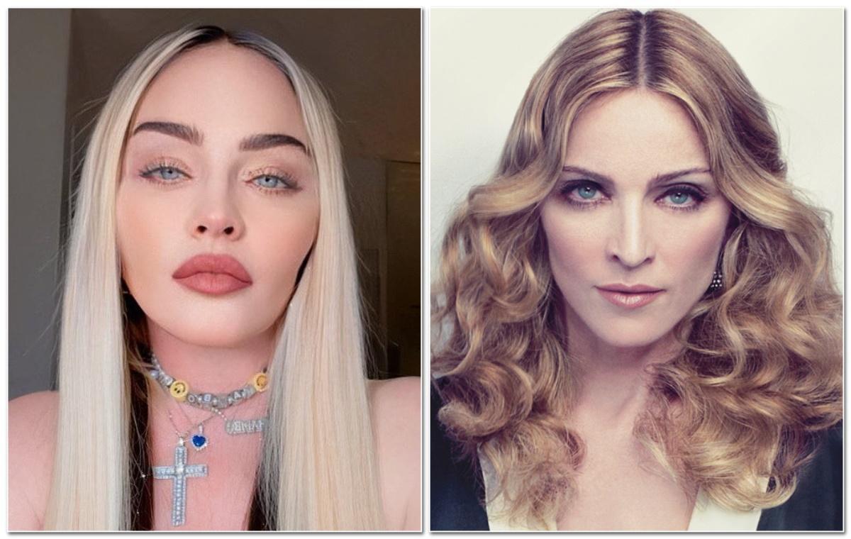 Así ha cambiado el rostro de Madonna tras su nueva operación estética.