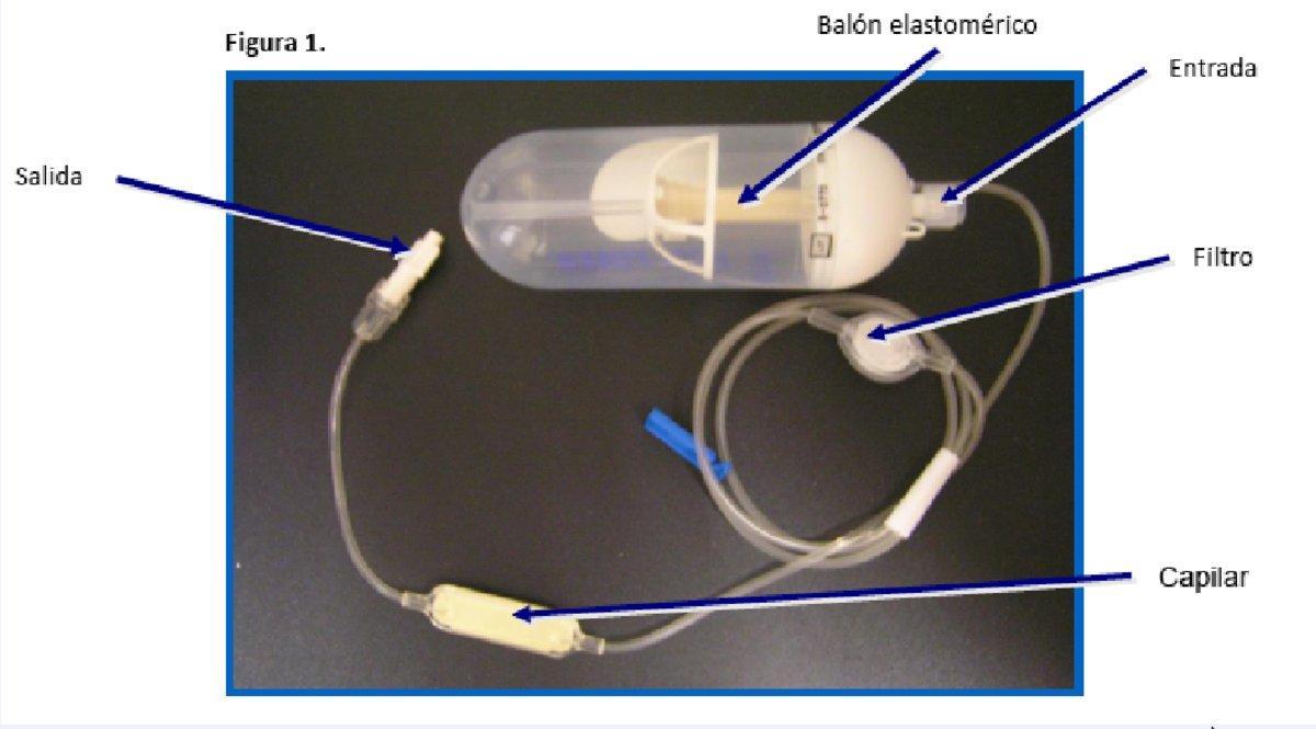 Dispositivo para perfundir analgésicos y opiáceos, tal y como se reproduce en el protocolo para sedación de pacientes terminales de Covid-19 de la Gerencia de Salud de Navarra.