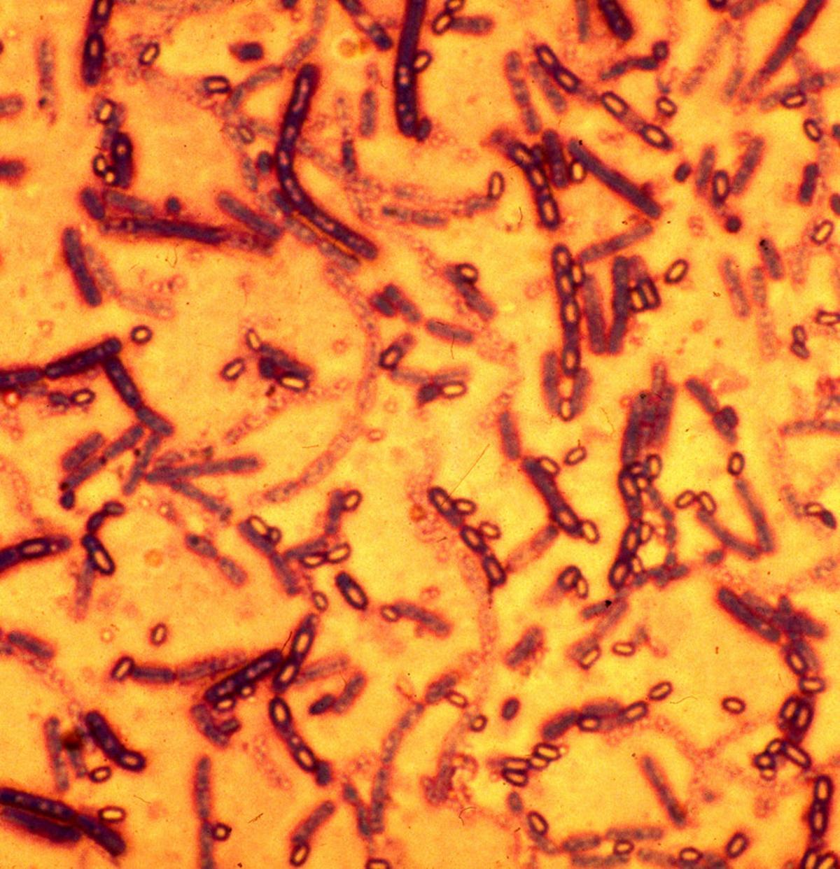 Клетка язвы. Сибиреязвенная бацилла микробиология. Bacillus anthracis, а22 (Сибирская язва).
