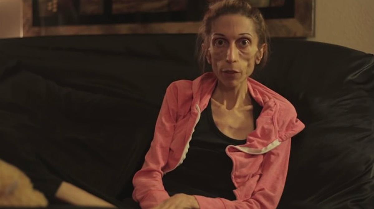Rachael Farrokh, la mujer con anorexia extrema que pide ayuda en