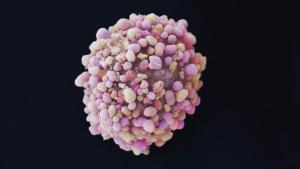 Imagen detallada de una célula con cáncer de mama.