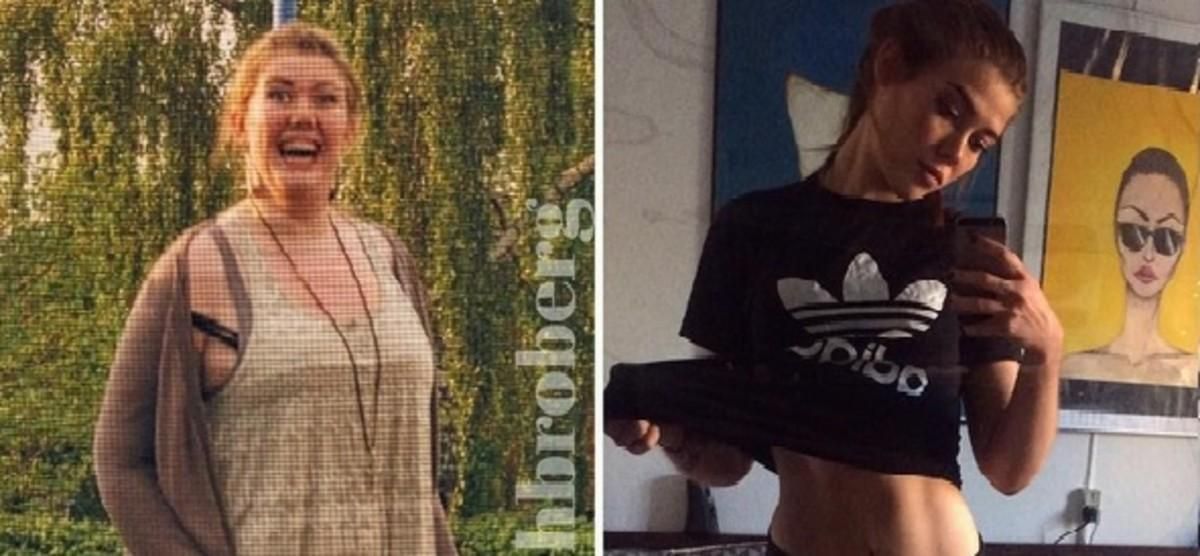 Mathilde Broberg, cuando pesaba 120 kilos, a la izquierda, y en la actualidad, con 67 kilos, a la derecha. Mathilde Broberg, cuando pesaba 120 kilos, a la izquierda, y en la actualidad, con 67 kilos, a la derecha.