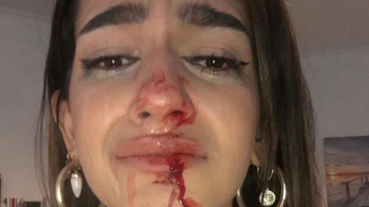 Els Mossos investiguen la pallissa a una jove transsexual a Barcelona Els Mossos investiguen la pallissa a una jove transsexual a Barcelona