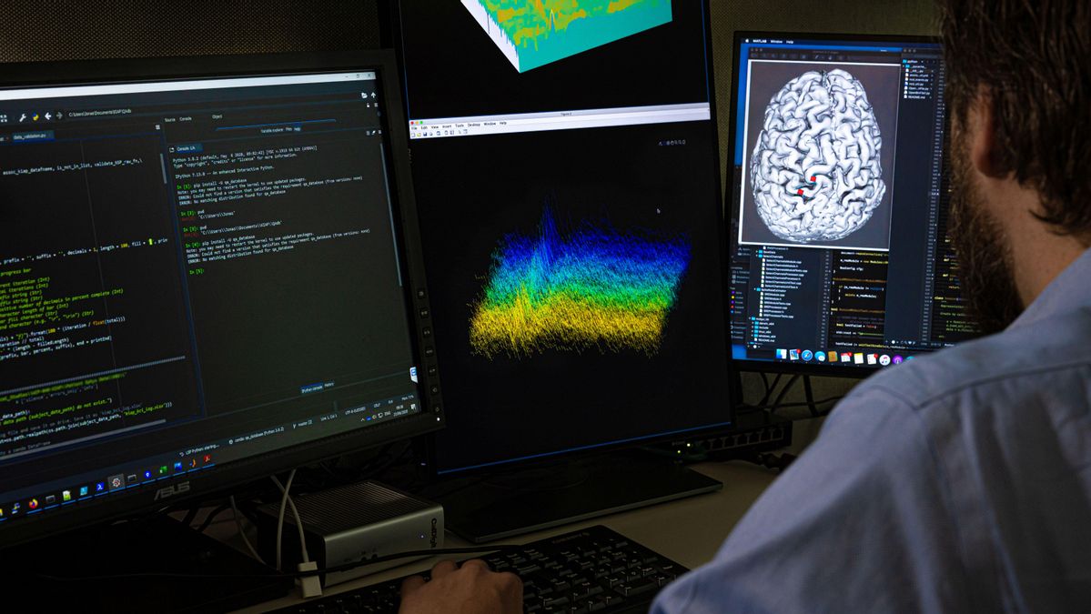 Un investigador trabaja en un estudio para conectar el cerebro de un paciente a un ordenador. Un investigador trabaja en un estudio para conectar el cerebro de un paciente a un ordenador.
