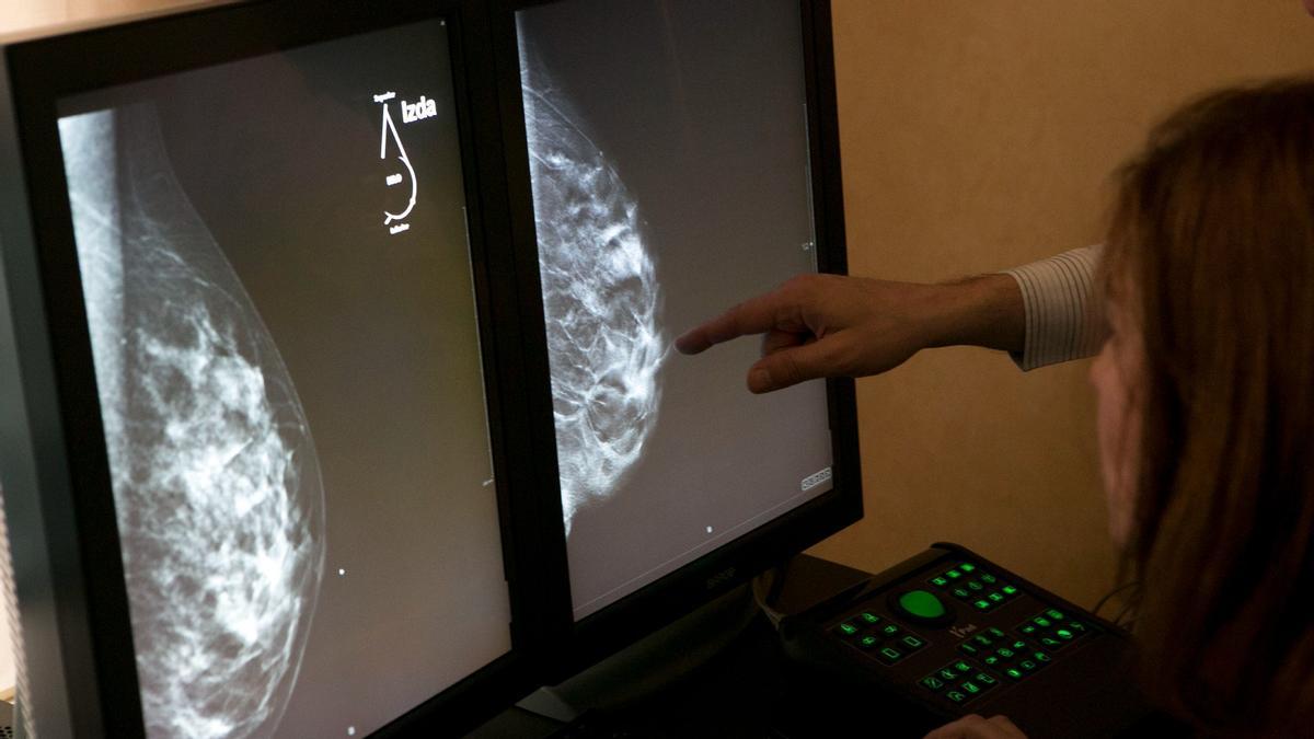 Observación de unas mamografías en 3D.