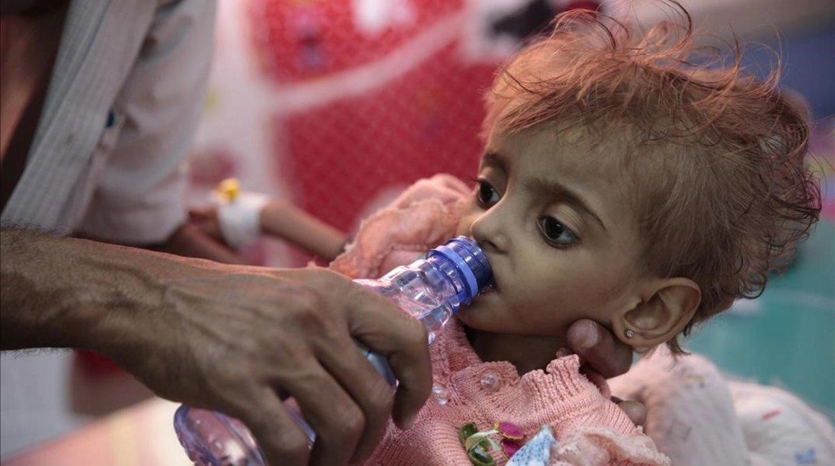 Una niña malnutrida en el hospital de Al Hudeida. 