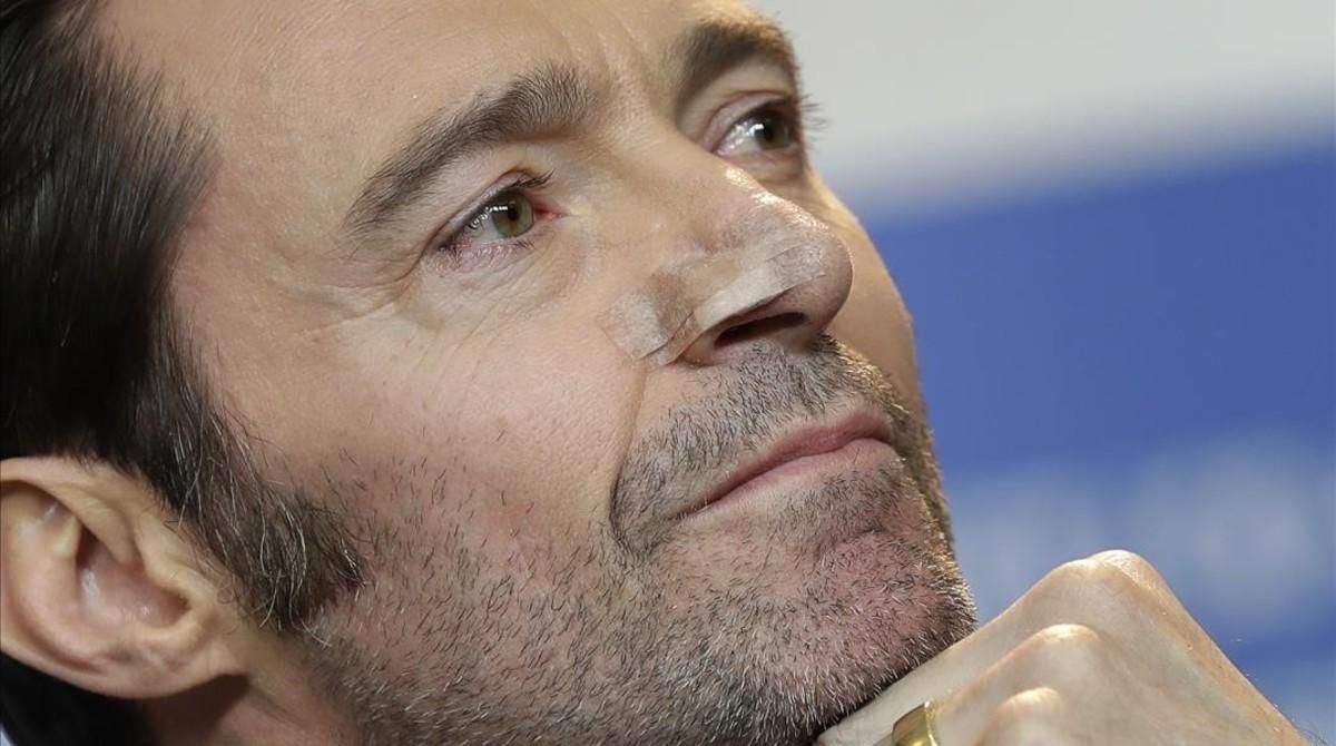 Hugh Jackman muestra las señales de la reciente intervención a que fue sometido para extirpar un carcinoma en la nariz. Hugh Jackman muestra las señales de la reciente intervención a que fue sometido para extirpar un carcinoma en la nariz.