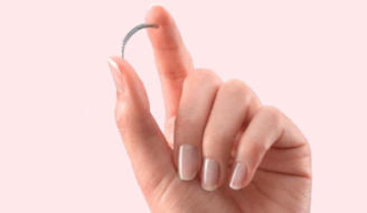 Sanidad retira temporalmente el anticonceptivo Essure Sanidad retira temporalmente el anticonceptivo Essure