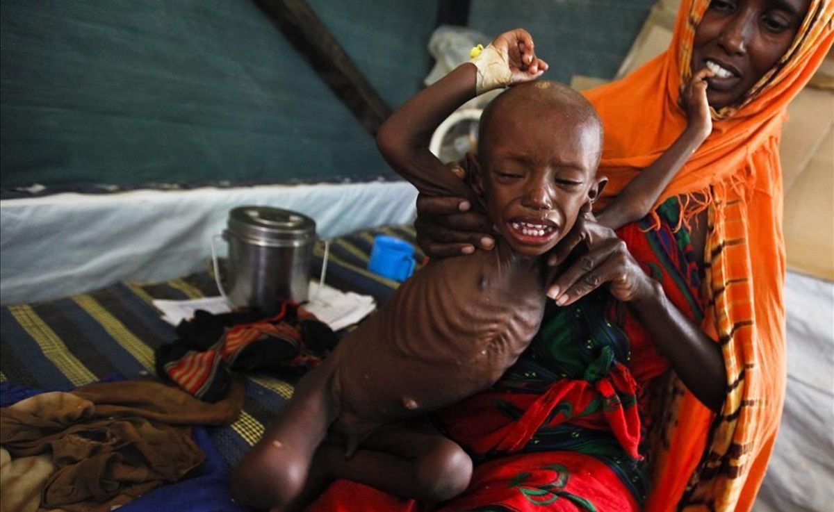 Un niño desnutrido, que huyó con su familia de los efectos de la sequía en el sur de Somalia, en un campamento para refugiados de Dadaab (Kenia). Un niño desnutrido, que huyó con su familia de los efectos de la sequía en el sur de Somalia, en un campamento para refugiados de Dadaab (Kenia).