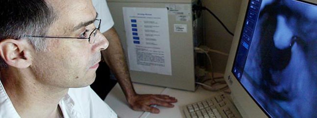 Un radiólogo ante la pantalla. Un radiólogo ante la pantalla.