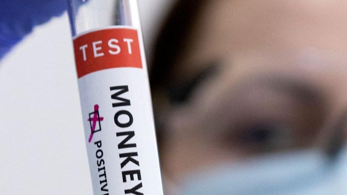Barcelona comptabilitza 747 contagis de verola del mico en dos mesos