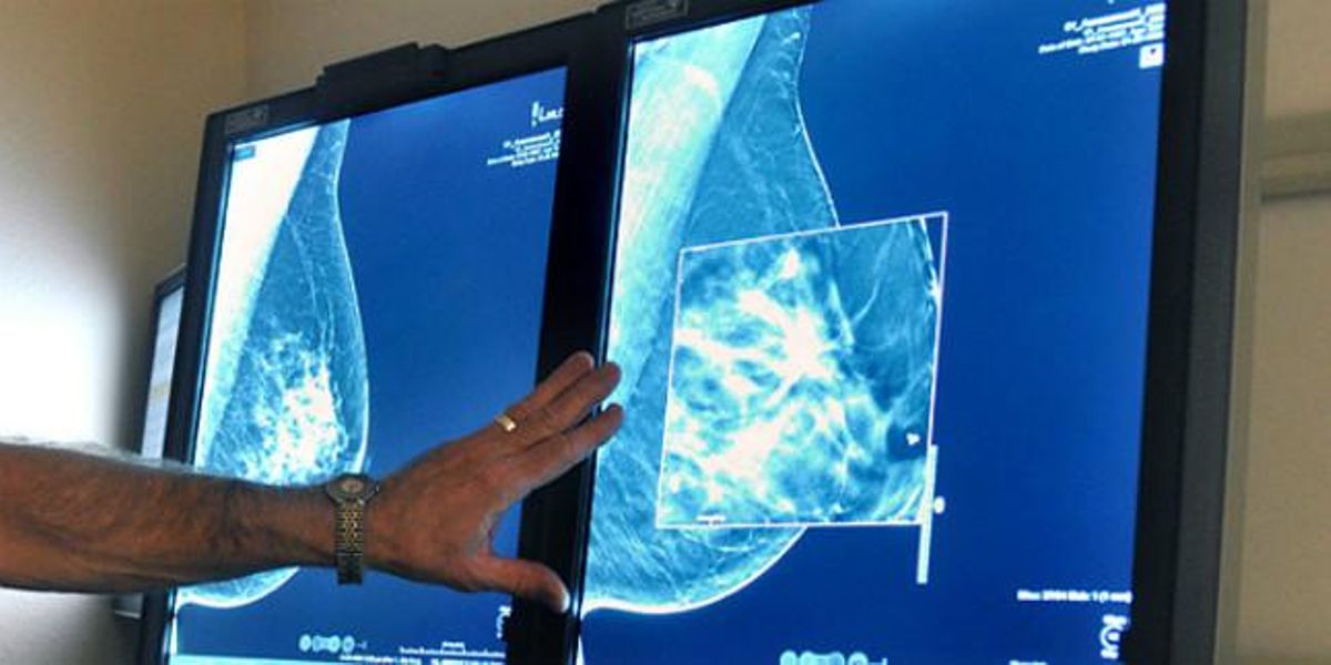 Un doctor observa la mamografía de una paciente. Un doctor observa la mamografía de una paciente.