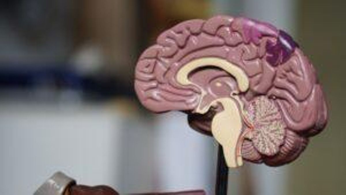 El consum d’aliments ultraprocessats augmenta les possibilitats de patir Alzheimer El consum d’aliments ultraprocessats augmenta les possibilitats de patir Alzheimer