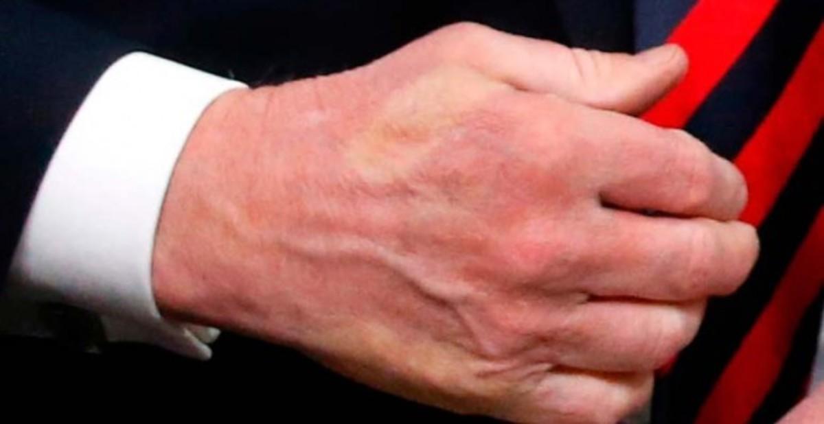 El dedo pulgar de Macron marcado en la mano deTrump tras el fuerte saludo de los mandatarios en el G-7.