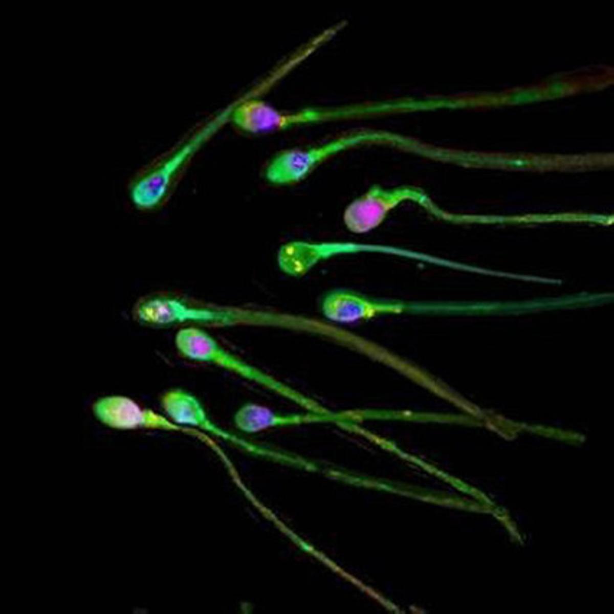 Fotografia d’esperma humana difosa per la revista ’The Journal of Science’.