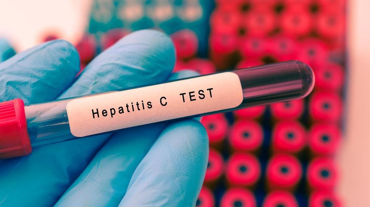 Muere el primer niño enfermo de hepatitis aguda en Reino Unido