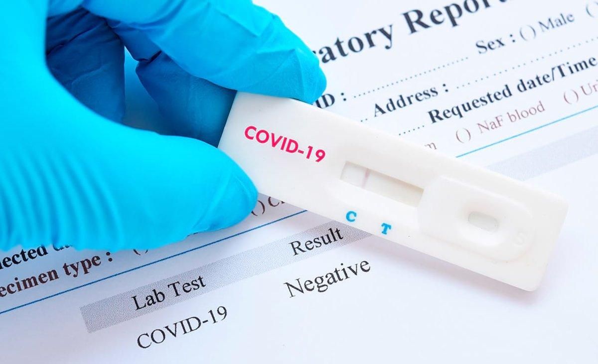 La Diputació de Barcelona distribueix als ajuntaments testos de detecció ràpida del coronavirus La Diputació de Barcelona distribueix als ajuntaments testos de detecció ràpida del coronavirus