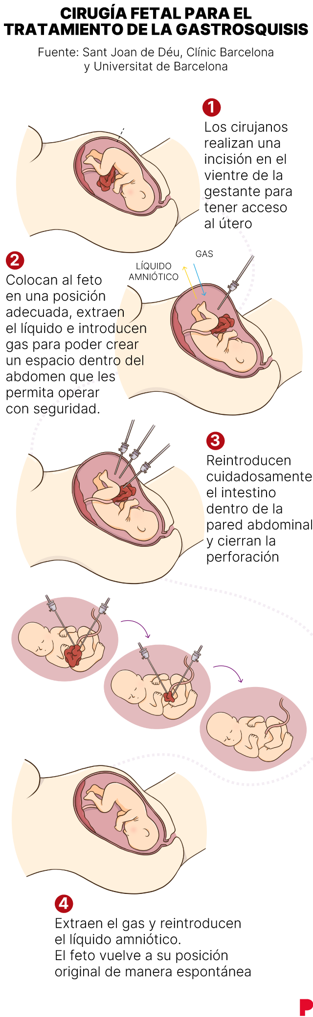 Imagen de operación